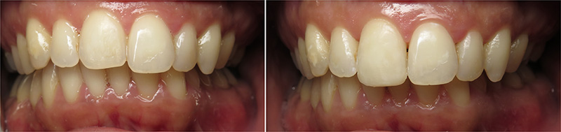 smile gallery picture