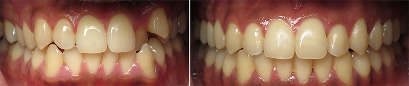 smile gallery picture