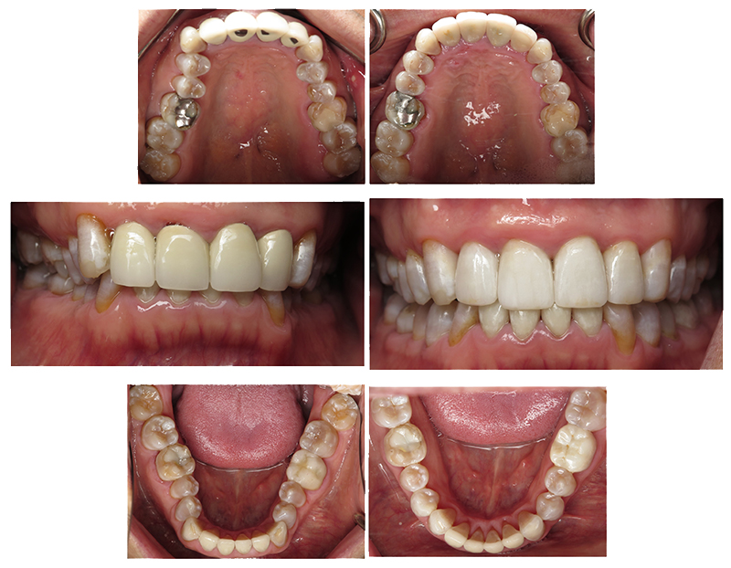 smile gallery picture