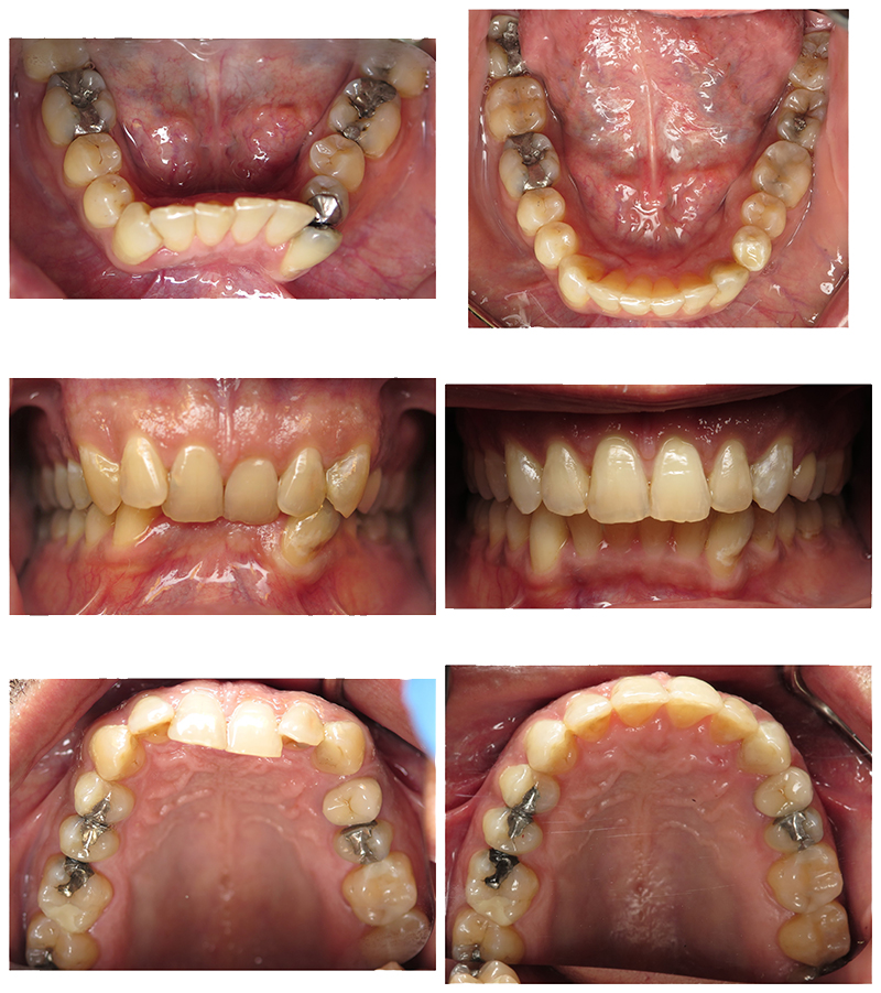 smile gallery picture