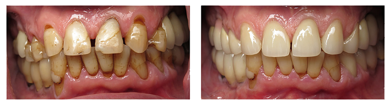 smile gallery picture