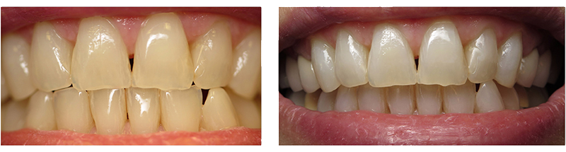 smile gallery picture