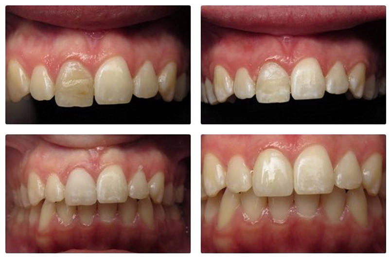 smile gallery picture