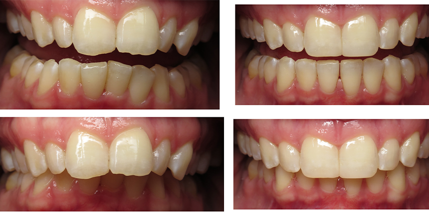 smile gallery picture