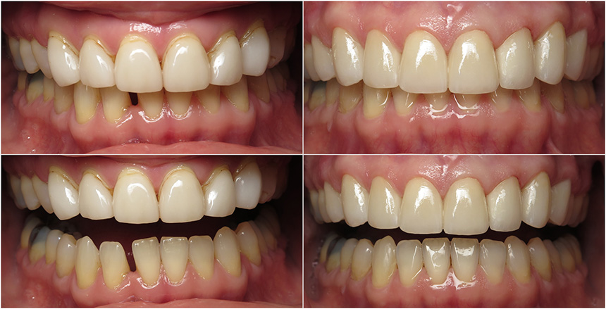 smile gallery picture